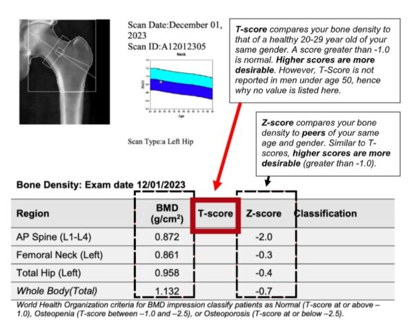 How Do I Read a DXA Bone Density Report? | Men's Health Boston